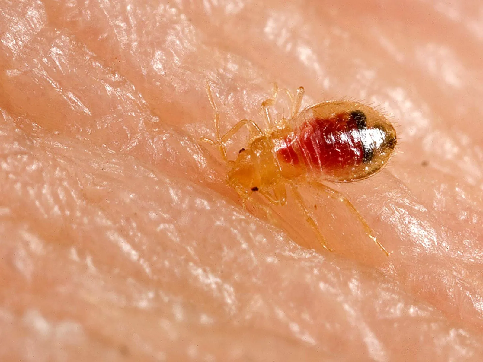 Larve de punaise de lit vue de dessus sur la peau, plus petite et plus claire que l'adulte, l'abdomen rouge de sang